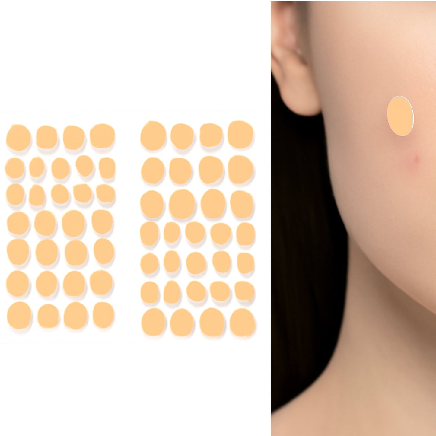 Pimple Patches