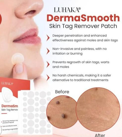 Derma Smooth Skin Tag Removal Patches (Pack Of 10)
