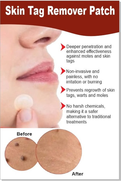 Derma Smooth Skin Tag Removal Patches (Pack Of 10)